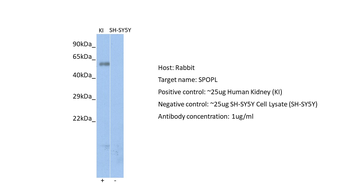 SPOPL Rabbit Polyclonal Antibody