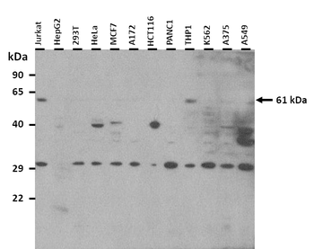 ZNF783 Rabbit Polyclonal Antibody