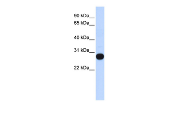 TCEAL4 Rabbit Polyclonal Antibody