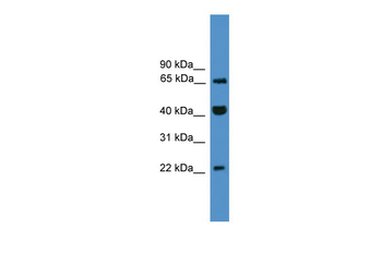TCEAL6 Rabbit Polyclonal Antibody