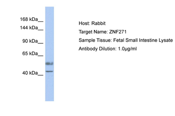 ZNF93 Rabbit Polyclonal Antibody