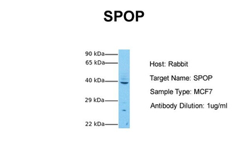 SPOP Rabbit Polyclonal Antibody