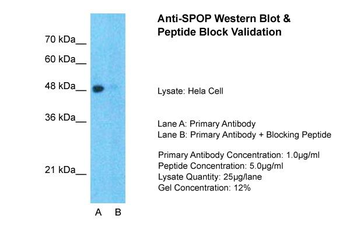 SPOP Rabbit Polyclonal Antibody