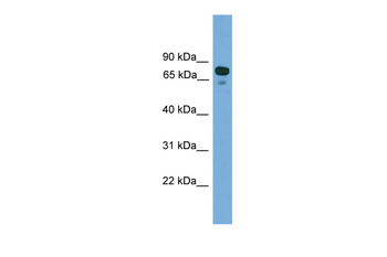 ZNF599 Rabbit Polyclonal Antibody