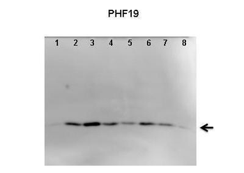 PHF19 Rabbit Polyclonal Antibody
