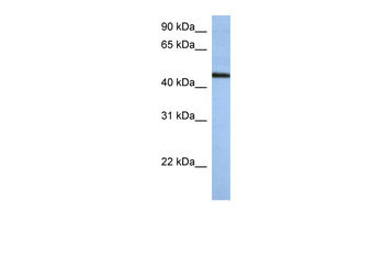 ZNF766 Rabbit Polyclonal Antibody
