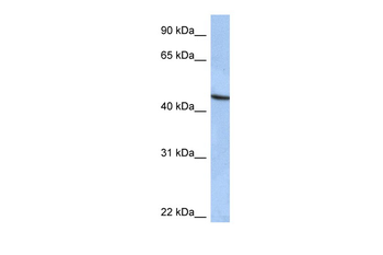 ZNF766 Rabbit Polyclonal Antibody