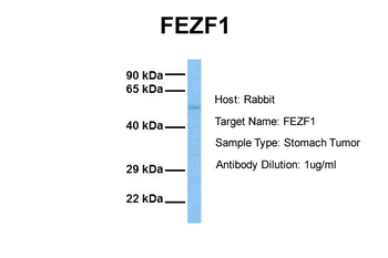 FEZF1 Rabbit Polyclonal Antibody