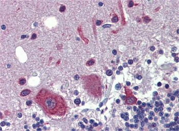 FEZF1 Rabbit Polyclonal Antibody