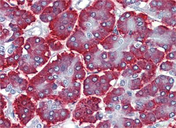 FEZF1 Rabbit Polyclonal Antibody