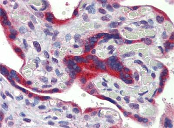 FEZF1 Rabbit Polyclonal Antibody