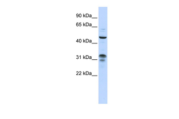 ZNF765 Rabbit Polyclonal Antibody