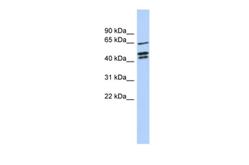 ZNF578 Rabbit Polyclonal Antibody