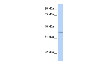 FHL3 Rabbit Polyclonal Antibody