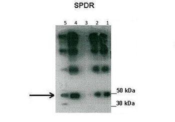 CAVIN2 Rabbit Polyclonal Antibody