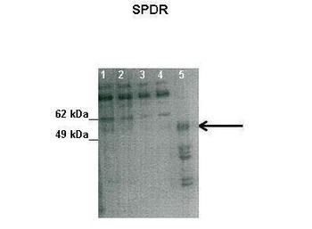 CAVIN2 Rabbit Polyclonal Antibody