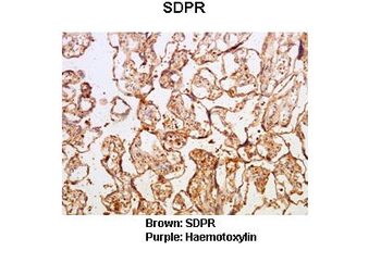 CAVIN2 Rabbit Polyclonal Antibody