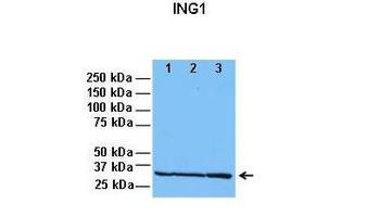 ING1 Rabbit Polyclonal Antibody