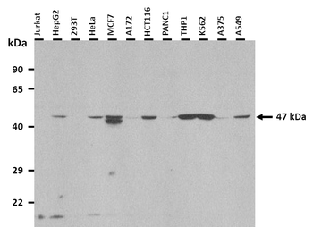 SMYD5 Rabbit Polyclonal Antibody