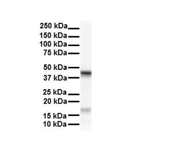 SMYD5 Rabbit Polyclonal Antibody