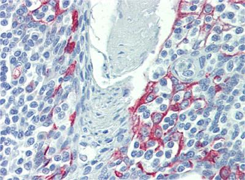 LIMD1 Rabbit Polyclonal Antibody