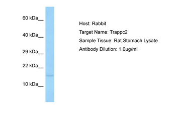 Trappc2 Rabbit Polyclonal Antibody
