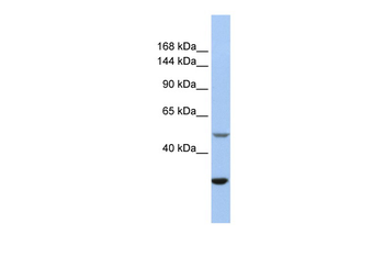 ZZZ3 Rabbit Polyclonal Antibody