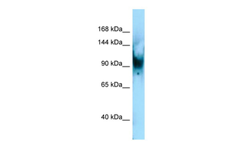 Senp6 Rabbit Polyclonal Antibody