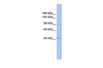 SENP6 Rabbit Polyclonal Antibody