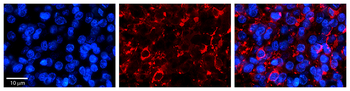 PTOV1 Rabbit Polyclonal Antibody