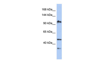 XAB2 Rabbit Polyclonal Antibody