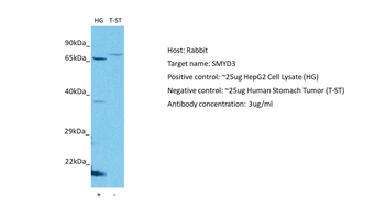 SMYD3 Rabbit Polyclonal Antibody
