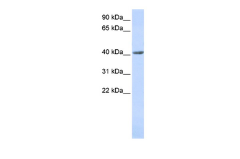 SMYD3 Rabbit Polyclonal Antibody