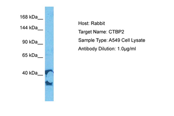 CTBP2 Rabbit Polyclonal Antibody