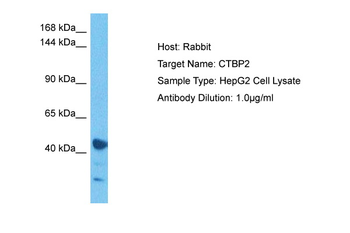 CTBP2 Rabbit Polyclonal Antibody
