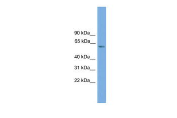 ZBTB46 Rabbit Polyclonal Antibody