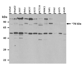 MED25 Rabbit Polyclonal Antibody
