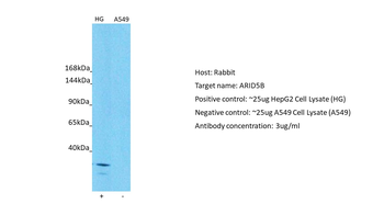 ARID5B Rabbit Polyclonal Antibody