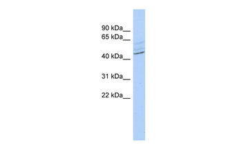 ZMYND12 Rabbit Polyclonal Antibody