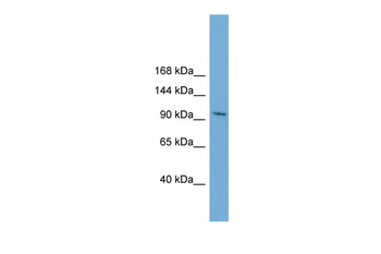 STK31 Rabbit Polyclonal Antibody
