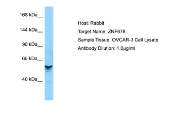 ZNF840P Rabbit Polyclonal Antibody
