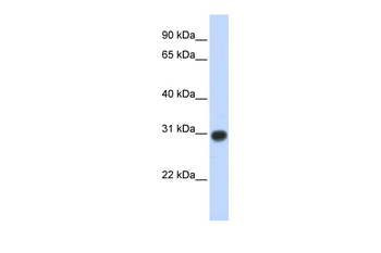 ZMYND19 Rabbit Polyclonal Antibody