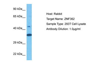 ZNF362 Rabbit Polyclonal Antibody