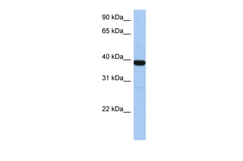 ZNF781 Rabbit Polyclonal Antibody