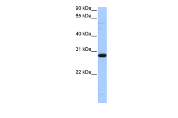 C1orf83 Rabbit Polyclonal Antibody