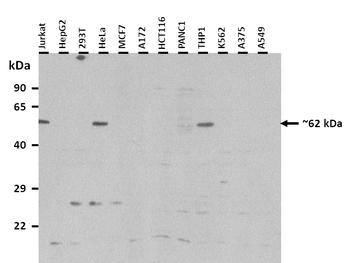 LIN9 Rabbit Polyclonal Antibody