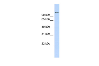 RBBP8 Rabbit Polyclonal Antibody