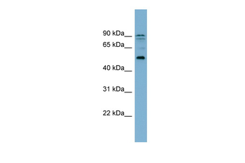 ZNF662 Rabbit Polyclonal Antibody