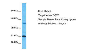 SSX3 Rabbit Polyclonal Antibody