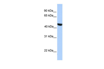 MSL3L2 Rabbit Polyclonal Antibody
